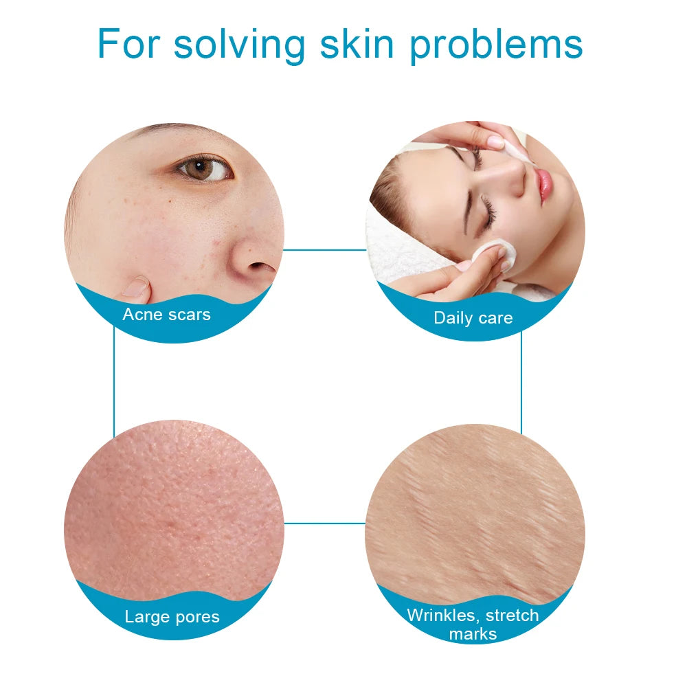 540 Derma Roller Skin Care Micro Needle Dermaroller Professional Derma