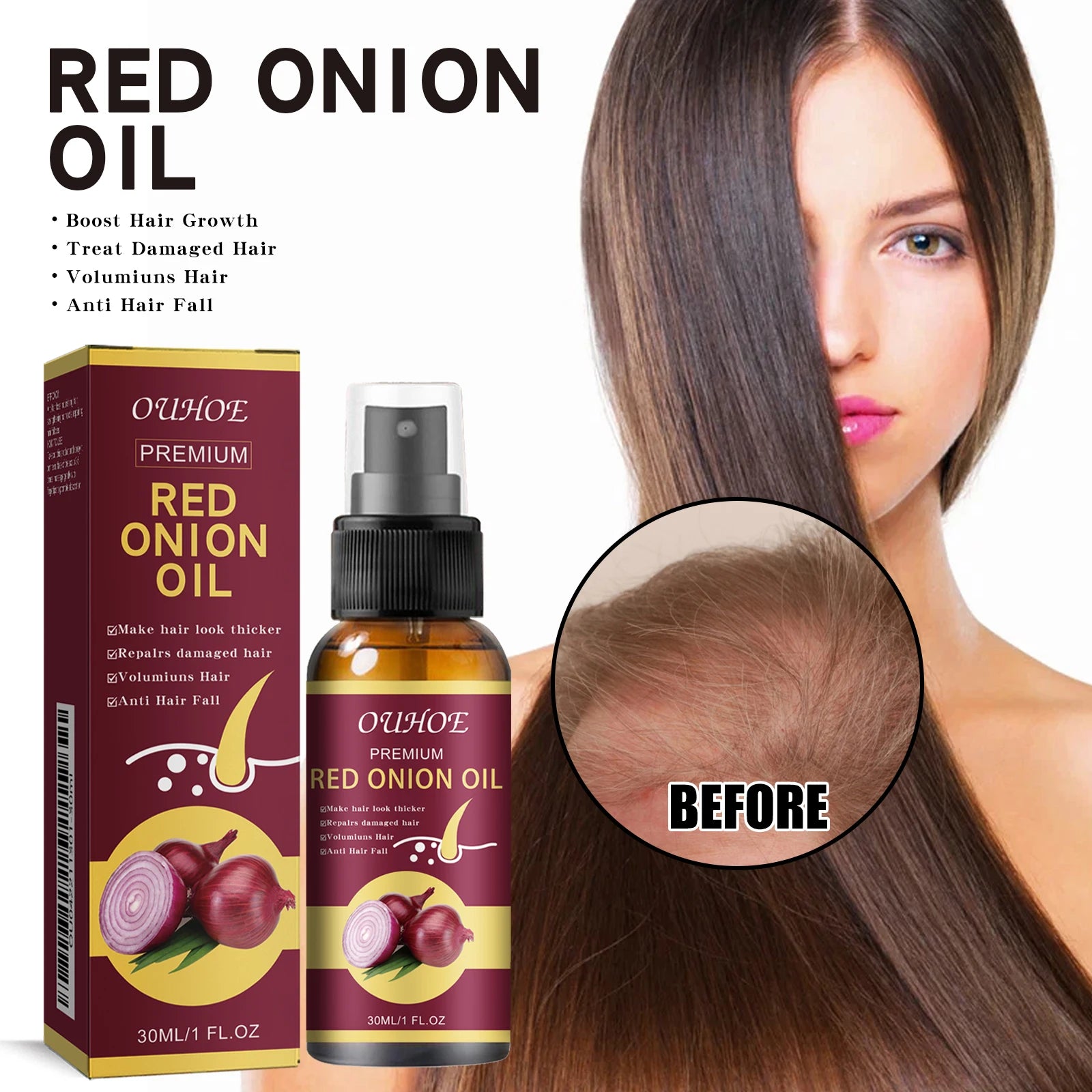 Red Onion Hair Growth Essential Oil Hair Care Spray Prevent Hair Loss Nourish Hair Roots Improve Hair Texture Hair Care Products