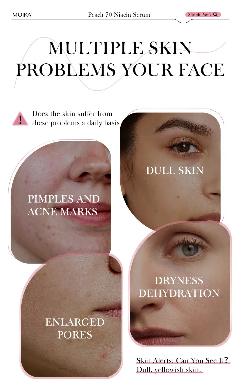 Niacinamide Serum Dark Spot Remover Fade Acne Marks Hyperpigmentation Shrink Pores Even Skin Tone Moisturizing Korea Skin Care 3